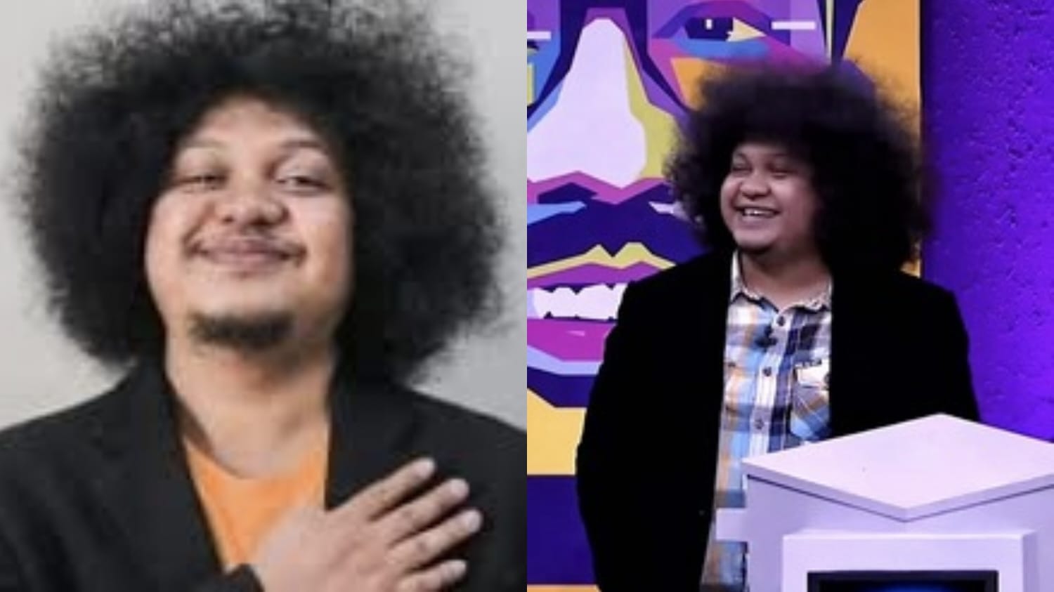 Babe Cabita Meninggal Dunia, Mengenal Penyakit Anemia Aplastik