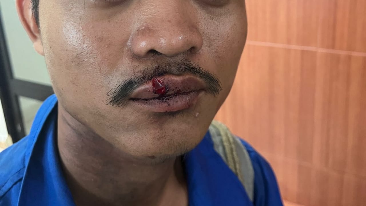 Dilaporkan di Polsek Batu Aji, Korban FW Berharap Kasusnya Diproses Secara Hukum hingga Tuntas